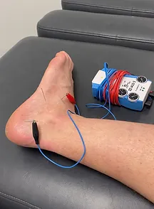 ankle pain and swelling acupuncture and laser therapy treatment