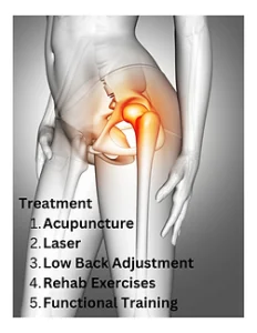 hip pain treatment plan