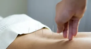 low back pain acupuncture