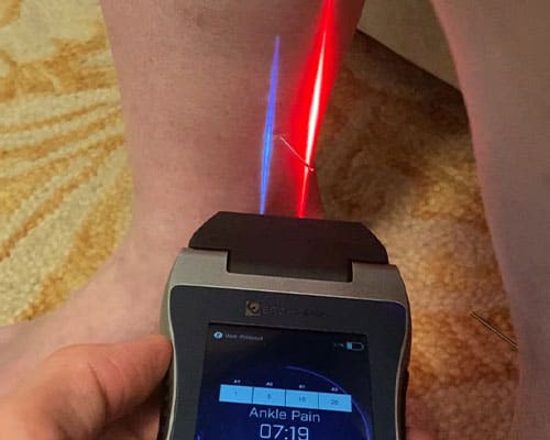 A patient receiving laser treatment in clinic for ankle pain