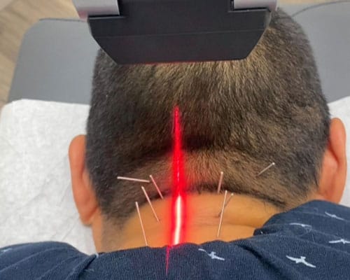 A patient receiving laser treatment in clinic for neck pain