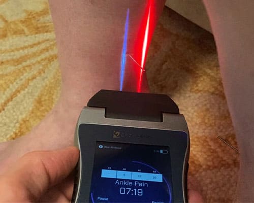 Laser treatment for neuropathy on ankle